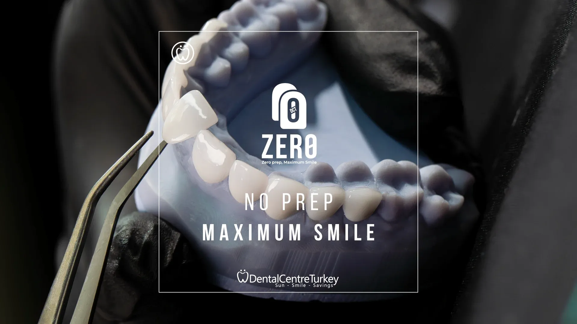 DCT Zero — No Prep, Maximum Smile